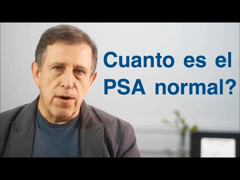 Video: ¿Cuál es el significado de PPSA?