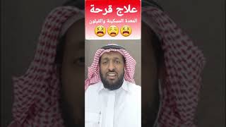 علاج قرحة المعدة والقيلون بسيط