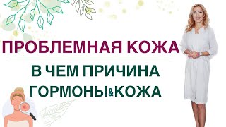 ❤️ ПРОБЛЕМЫ С КОЖЕЙ, В ЧЕМ ПРИЧИНА❓ГОРМОНЫ, ПИТАНИЕ И КОЖА Врач эндокринолог, диетолог Ольга Павлова