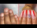 HOW TO: Easy Acrylic Nails Fullset On Short Bitten Nails *step by step*