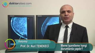 Meme Işaretleme Hangi Durumlarda Yapılır?