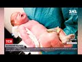 Новини світу: 31-річна британка народила дитину вагою майже 7 кілограмів