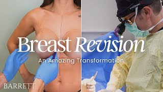 Intricate Breast Implant Revision Surgery With Natural Looking Results! | Barrett