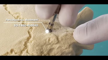 Placing the AHEAD Implant Percutaneous Abutment | Craniofacial Implant Surgery