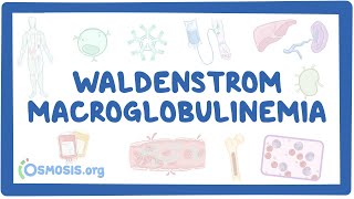 NORD - Waldenstrom Macroglobulinemia