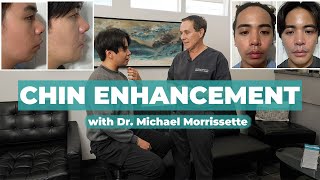 Chin Enhancement with Dr. Michael Morrissette