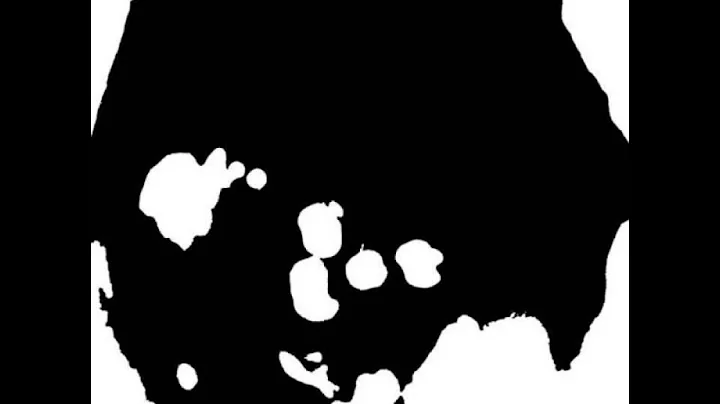 Radiohead - Burn The Witch (HQ)