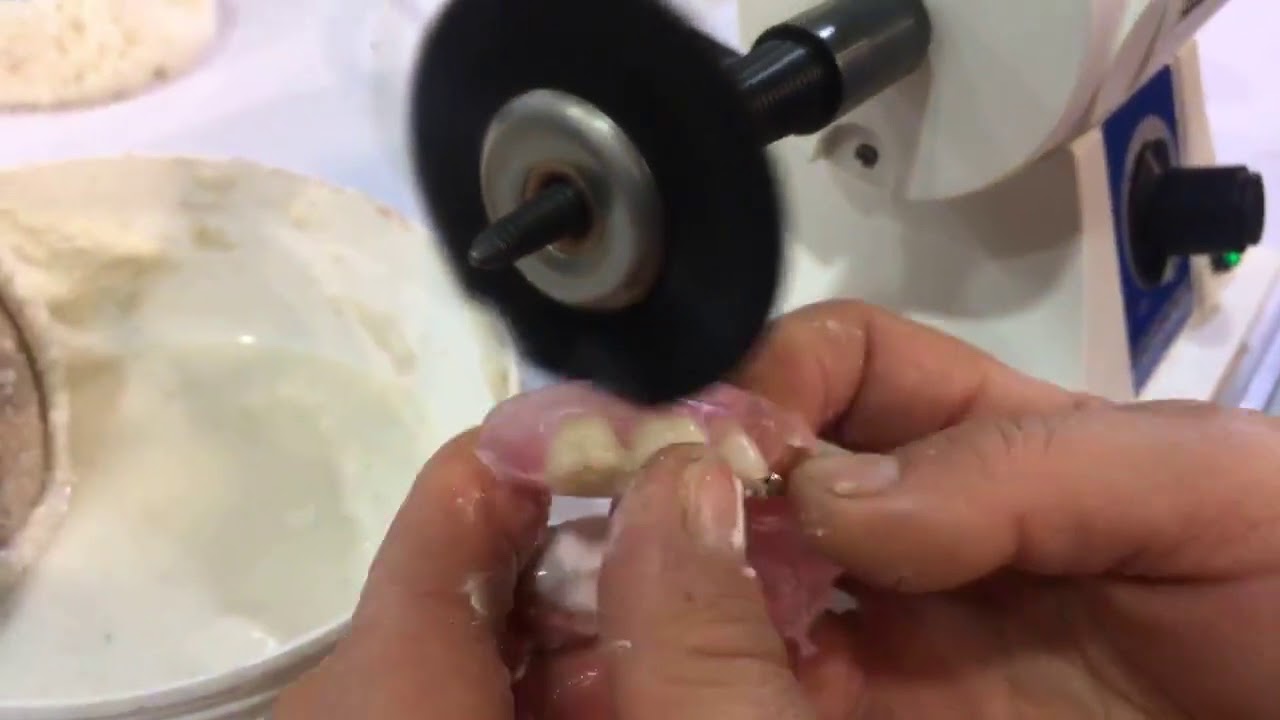 Pulido y abrillantado con Partial Flex de CLEMDE.