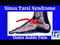 Sinus Tarsi Syndrome (Outer Ankle Pain)