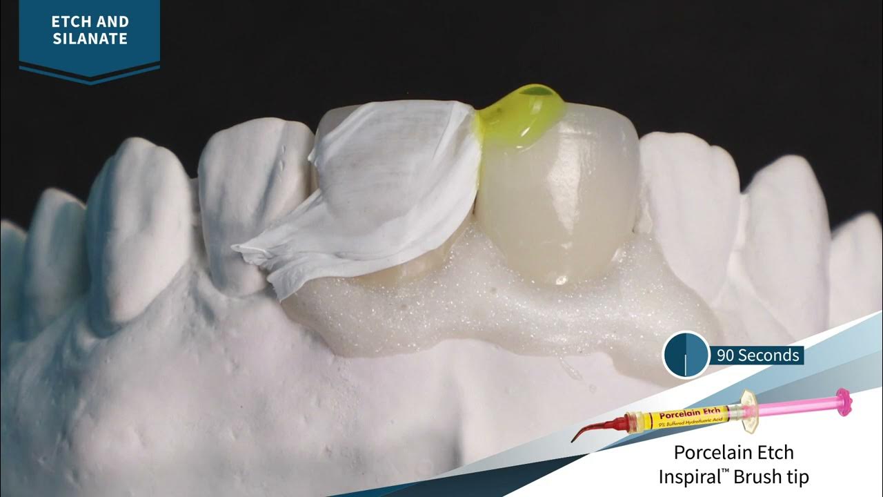 How to Use Ultradent™ Porcelain Repair Kit Step by Step 1 YouTube