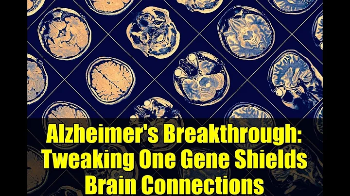 Alzheimer's Breakthrough: Tweaking One Gene Shields Brain Connections