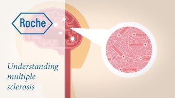 Understanding multiple sclerosis and what it does to the body