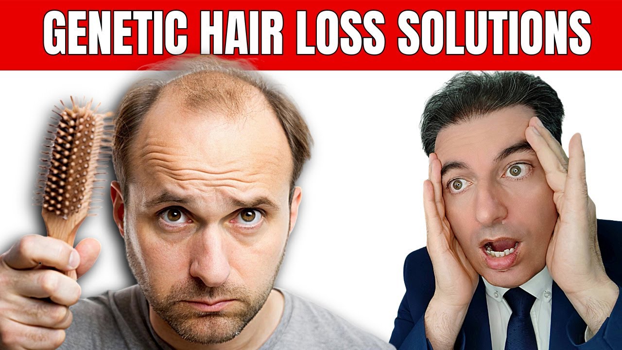 Как остановить ВЫПАДЕНИЕ ВОЛОС? Если вы сделаете это, у вас будут густые ВОЛОСЫ…