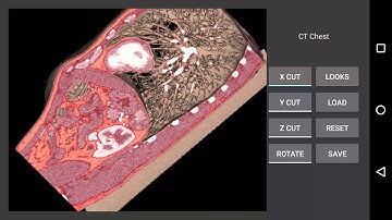 Volume Rendering