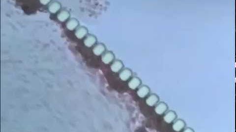 Clogging-free microfluidics for continuous size-based separation of microparticles
