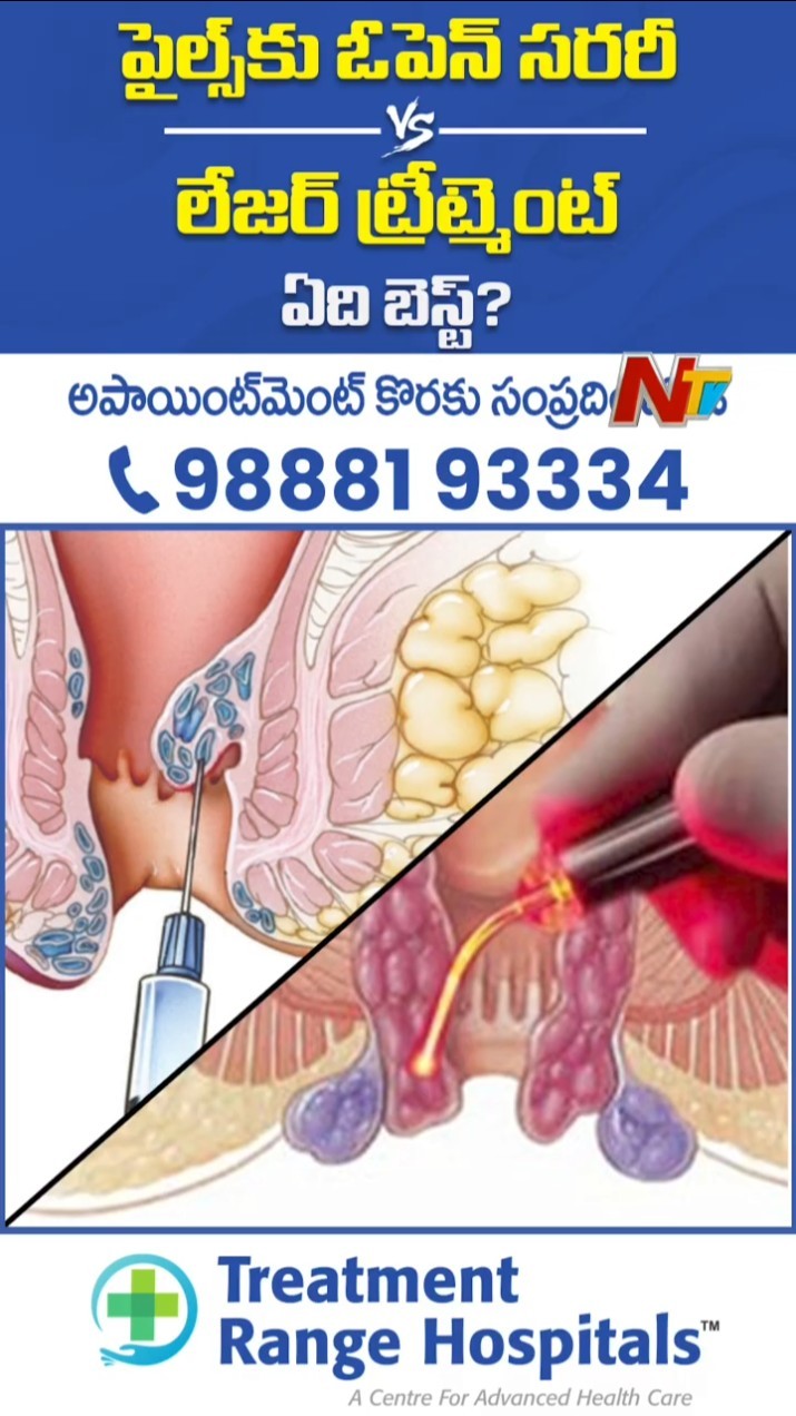 Piles Laser Surgery | Best Treatment for Piles | Treatment Range Hospitals, KPHB Hyderabad | NTV