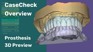 CaseCheck Overview: Prothesis 3D Preview