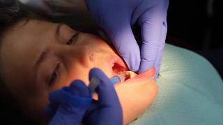 My Technique: How I Use Anutra for Pediatric Patients screenshot 1