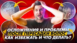 видео: 🔴 Популярные проблемы после пересадки волос: как избежать и что делать если они появились? KRASAV4IK картинка: 🔴 Популярные проблемы после пересадки волос: как избежать и что делать если они появились? KRASAV4IK