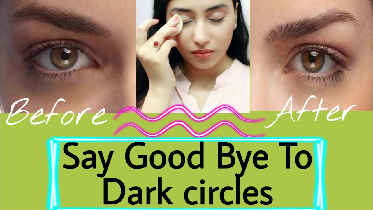 how to get rid of dark circles and puffiness how to get rid of dark circles and puffiness