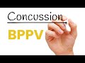 Dizziness After Concussion: BPPV Treatment 🌀