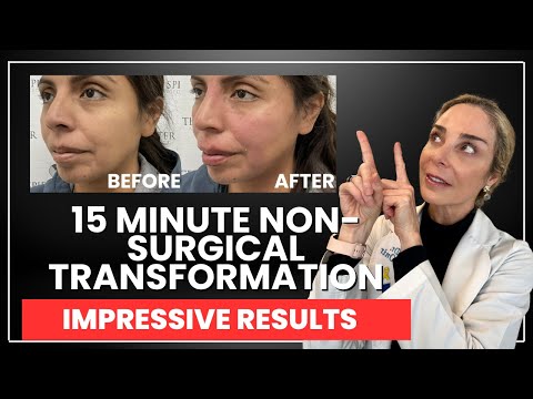 Video thumbnail: 15-Minute Miracle: The Secret to Instant Facial Transformation! · The Spiegel Center