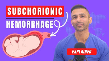 Subchorionic Hemorrhage Explained | Causes & Treatment #womenshealth #miscarriage #pregnancy