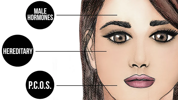 How common is female facial hair? (2023)