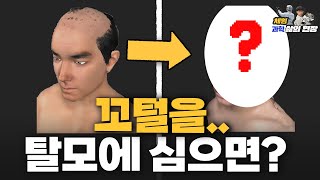 탈모 때문에 이것까지 연구했다..?