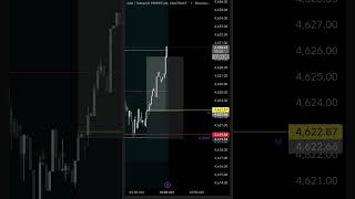 Today 2r #trading #forex #future #futuretrading #forextrading #trader #xauusd