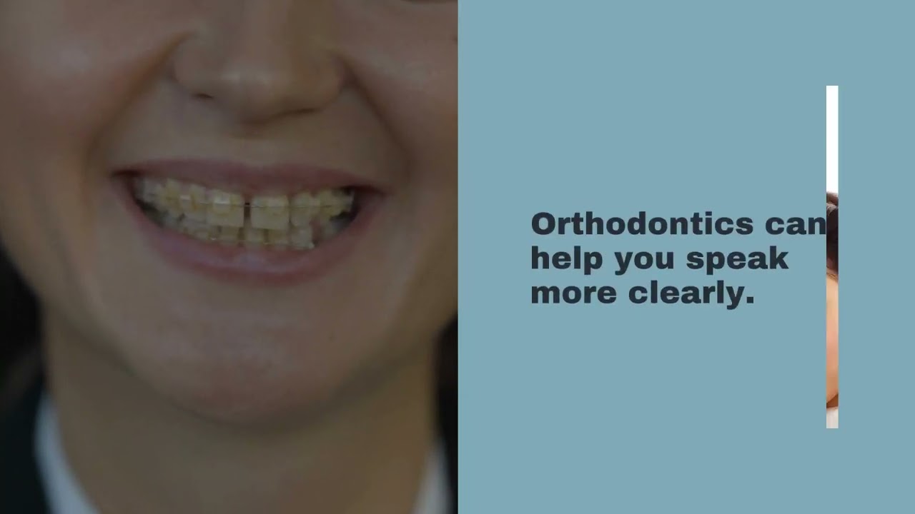 Dentist Round Rock, TX - Get The Perfect Smile with Orthodontics