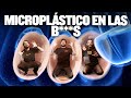 Los microplsticos sern el fin del ser humano  ep 573