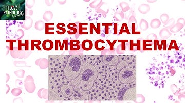 Essential Thrombocythemia (ET) Simplified | JAK2 Mutation, Morphology, Diagnosis & Treatment