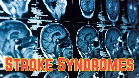 Stroke Syndromes (updated 2023) - CRASH! Medical Review Series