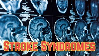 Stroke Syndromes (updated 2023)  CRASH! Medical Review Series