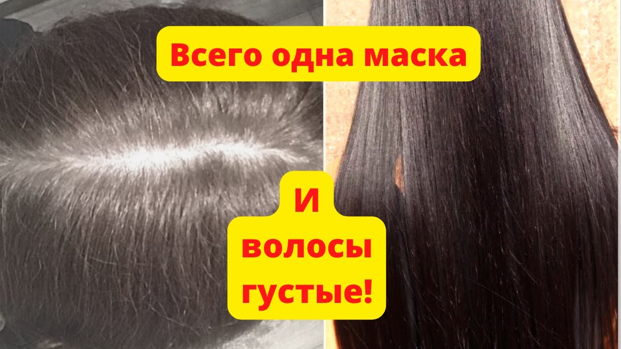 Выпадение волос | Как избавиться от Выпадения ВОЛОС в Домашних Условиях .РЕЦЕПТ.