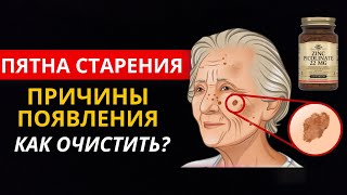 Настоящие Причины Пигментных Пятен(Пятен Старения)