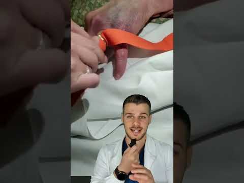 Video: 3 modi per tagliare un anello