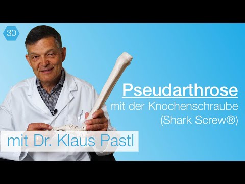 Video: Was kann man bei einer Pseudarthrose tun?