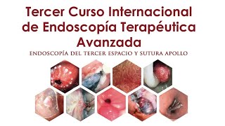 Casos en Vivo - Curso CEMexico 2019