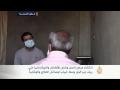 ظهور حالات إصابة بمرض السل