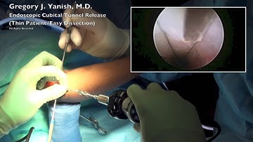 Endoscopic Cubital Tunnel Release