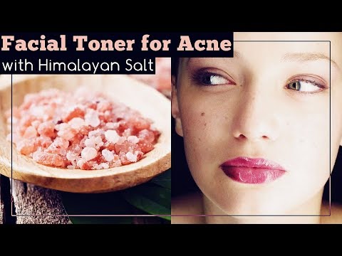 Homemade Facial Toner for Acne