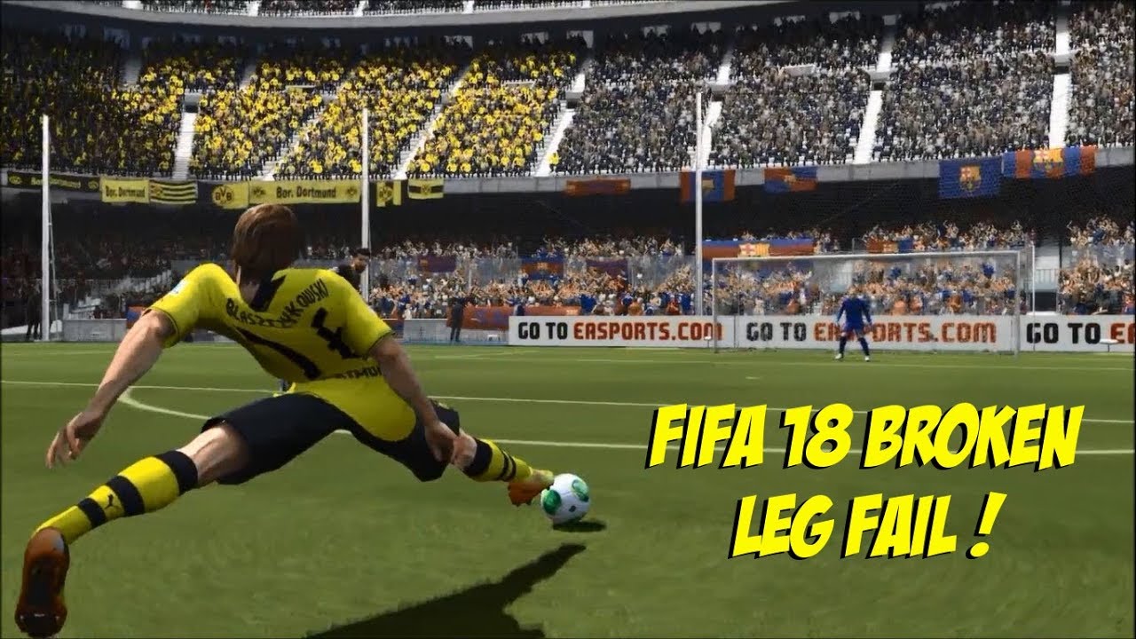 FIFA 18 Fail Broken leg Bakayoko