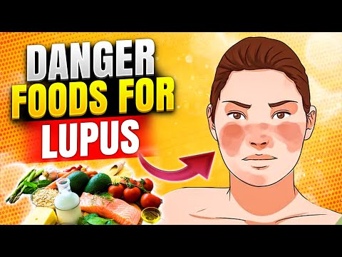 AUTO-IMMUNE DISEASE Foods That Can Aggravate Lupus Symptoms Lupus nephritis Rheumatologic