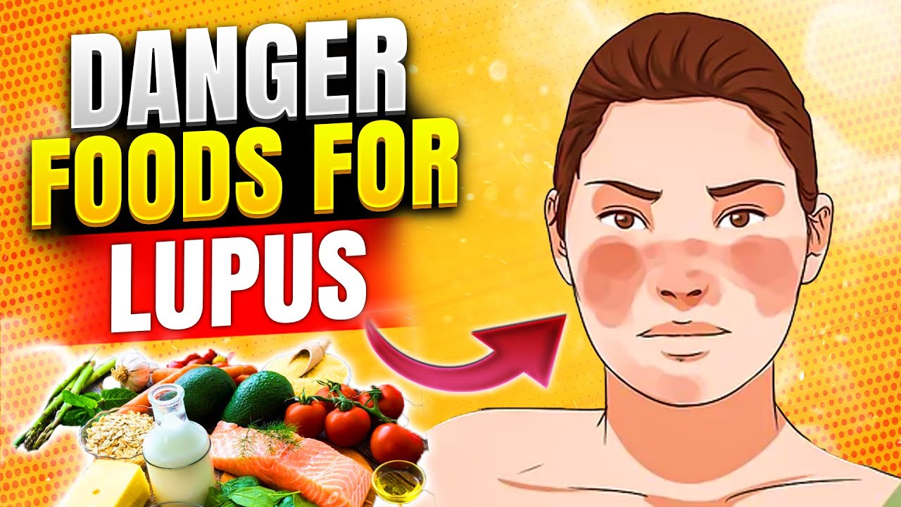 AUTO-IMMUNE DISEASE | Foods That Can Aggravate Lupus Symptoms | Lupus nephritis | Rheumatologic