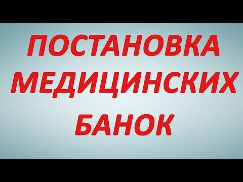 Как ставить банки