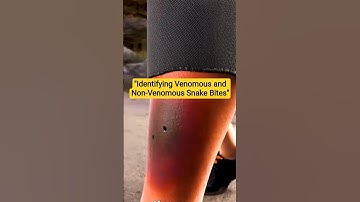 Identify Poisonous vs Non-Poisonous Snake Bites