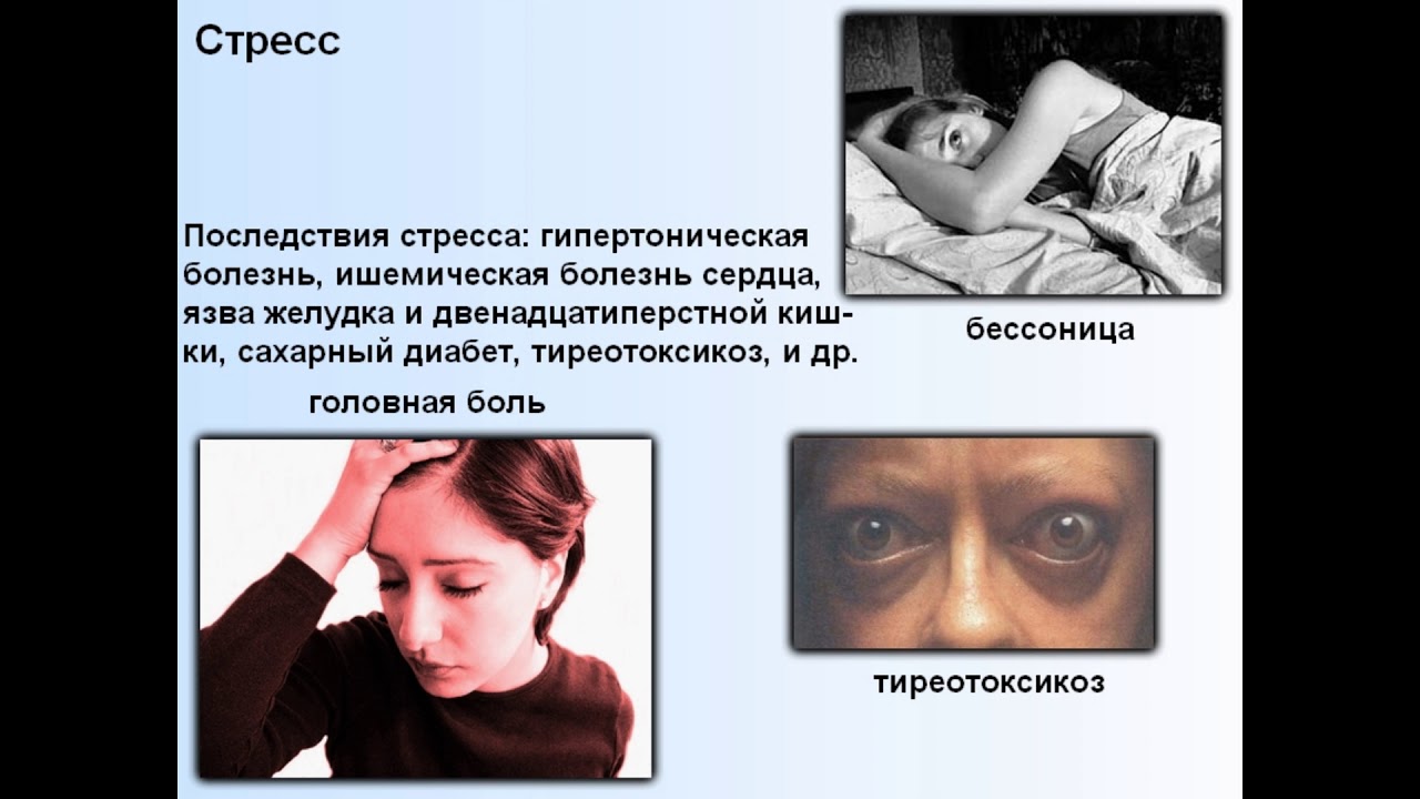 Стресс