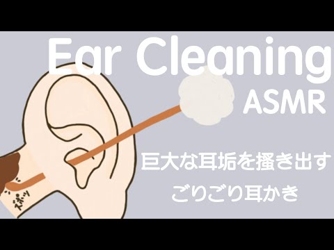 【ASMR】巨大な耳垢を搔き出すごりごり耳かき Ear Cleaning 귀 청소 【No Talking】